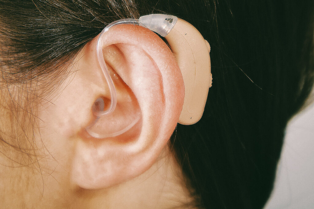 Beige behind-the-ear hearing aid worn by a brunette woman.
